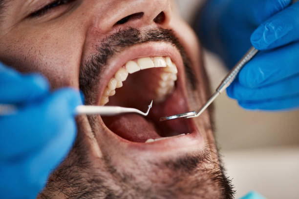 Best Dental Abscess Treatment in St Clair, MO